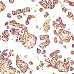 sars-cov-2 gene expression in a human fetus
